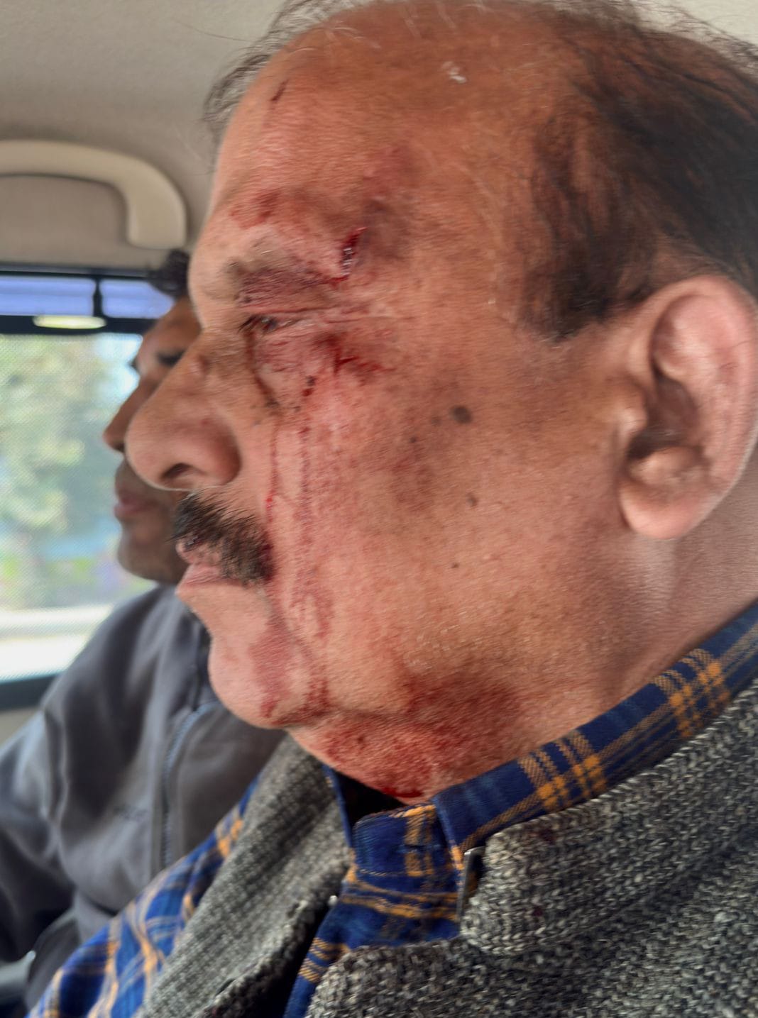 राजधानी में सियासी भूचाल: शिक्षा निदेशक पर हमला, विधायक पर आरोप; बोर्ड परीक्षा पर संकट